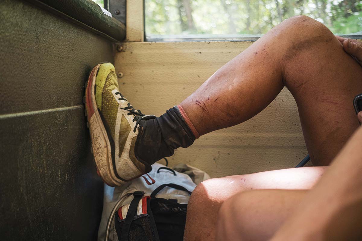 Scraped leg and trail running shoe